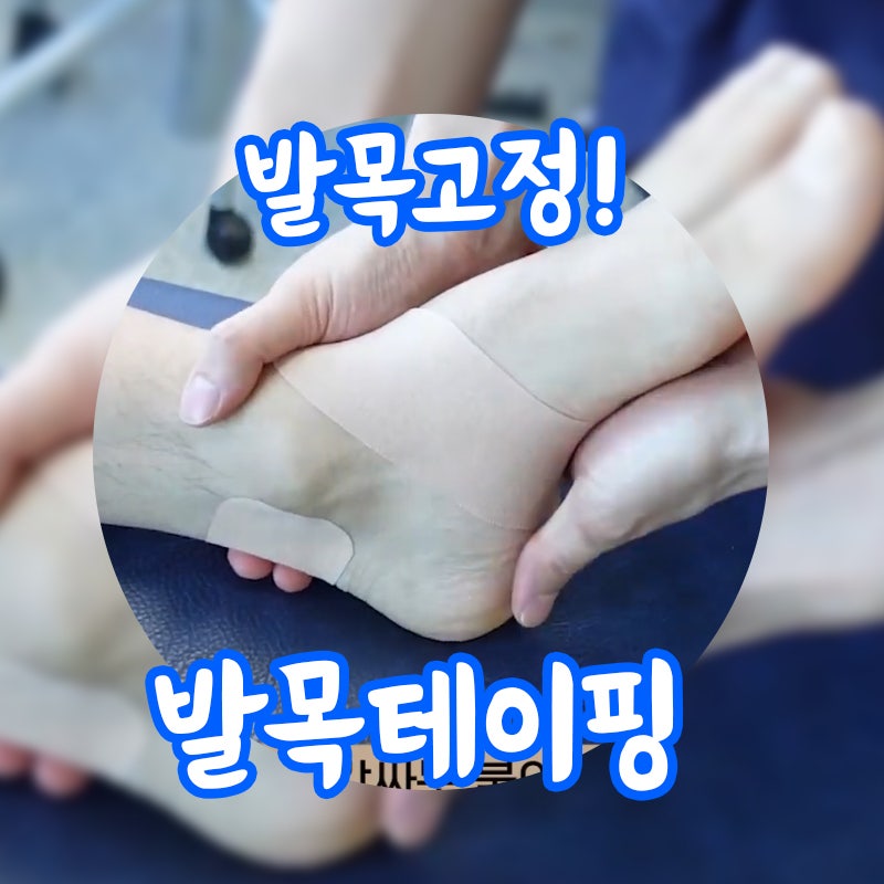 발목 접질렀을때 발목 테이핑 방법 | 부천 발목 통증