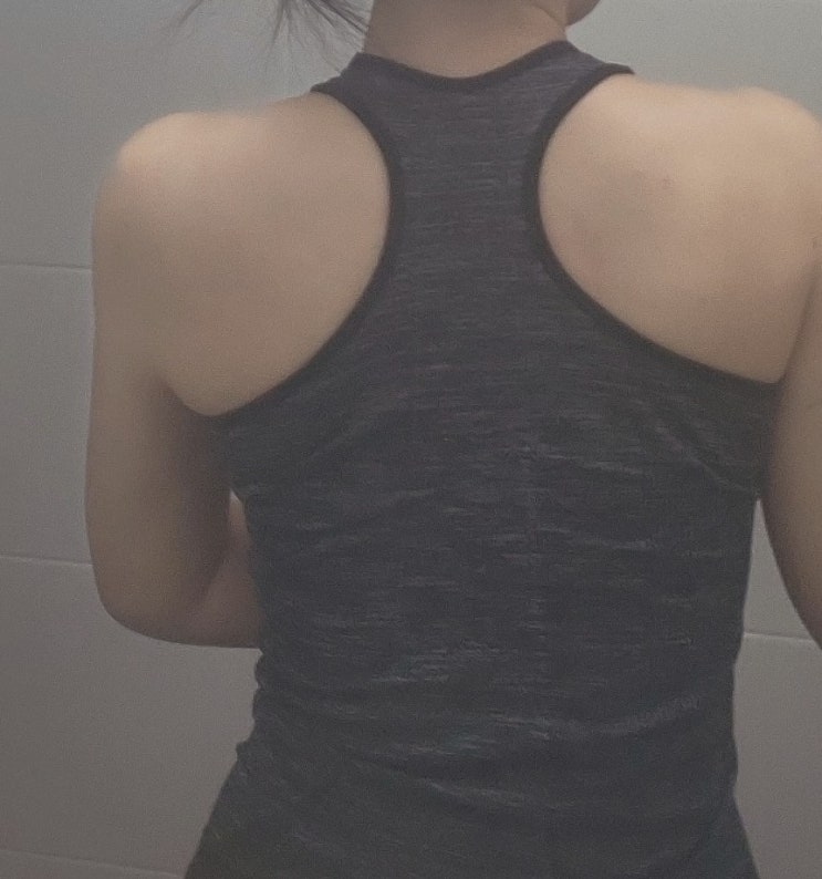  신사 지방흡입 팔둘레 슬림해지고 있고나:)