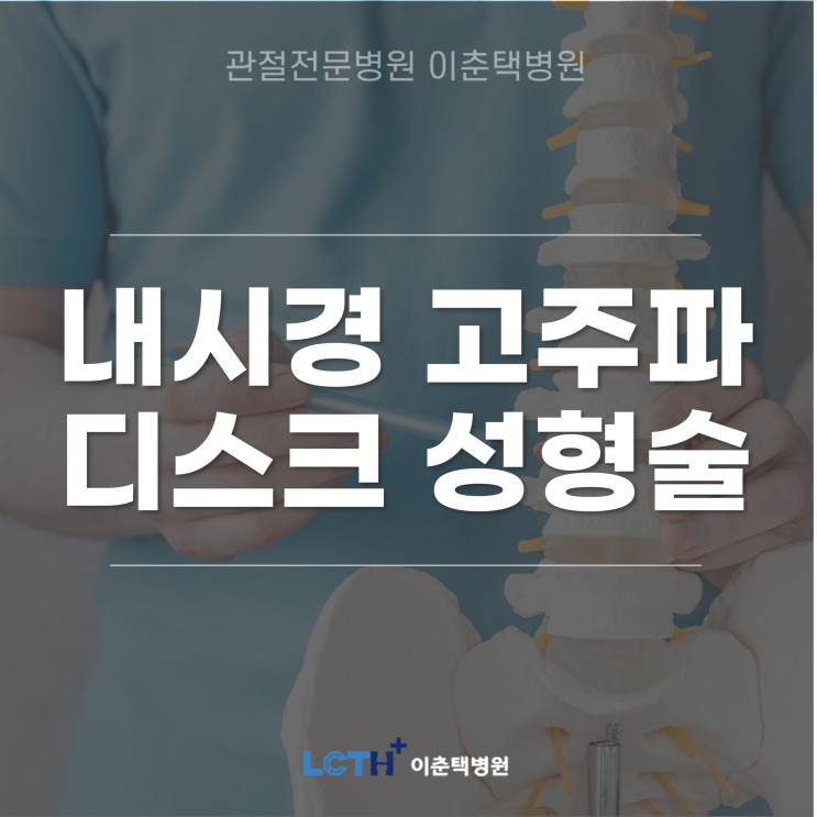  내시경 고주파 디스크 성형술이란? 시술방법 및 시술 후 회복기간, 시술대상