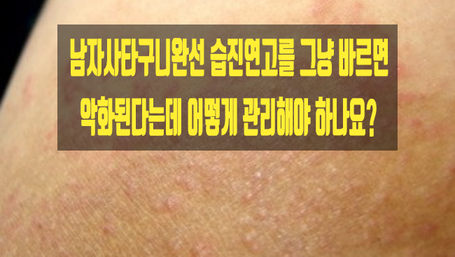  남자사타구니완선 습진연고를 그냥 바르면 악화된다는데 어떻게 관리해야 하나요?