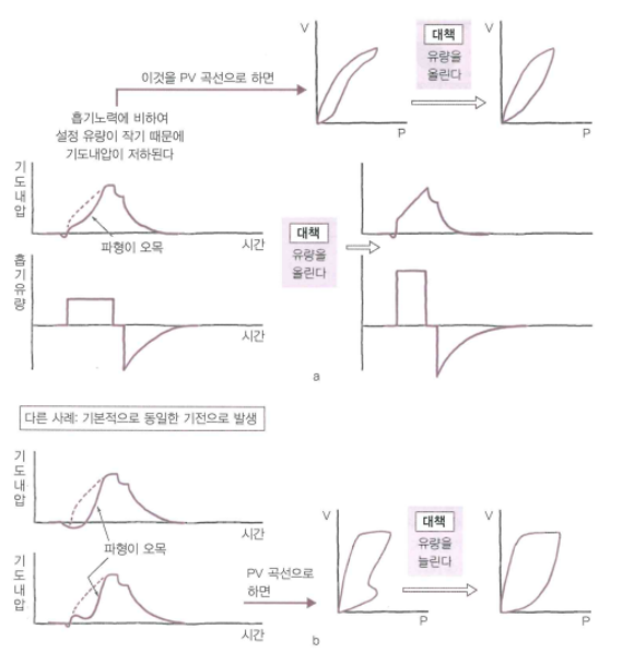  Mechanical Ventilator(Ⅱ) : Ventilator fighting