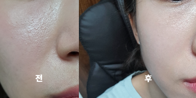 콜라겐 화장품) 리터나 플라 에스테틱 콜라겐 화장품) 리터나 플라 에스테틱