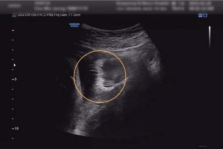  [임신 38주] 엄마 뱃속이 좋은 반짝이(?) : 은평성모병원 산부인과