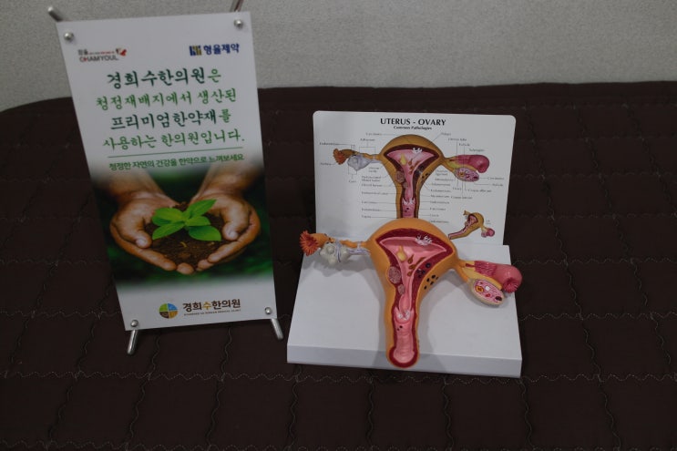  수원유산후보약 습관성유산과 혈성분비물