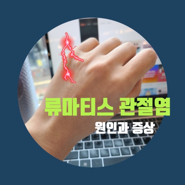  손가락 부었을때 의심되는 류마티스 관절염 증상 원인