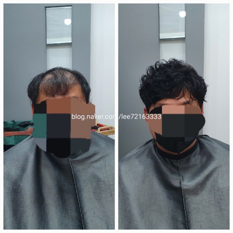  일반가발에서 보톡스증모로 바꾸면 좋은점  춘천가발 춘천증모전문점