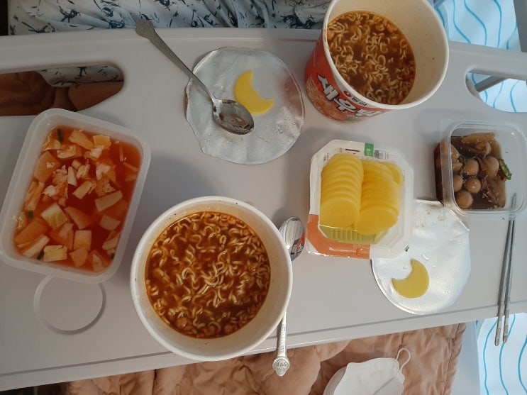  아산병원입원 4일차/뇌동맥류 수술(비파열성)3일차/아산병원 편의시설
