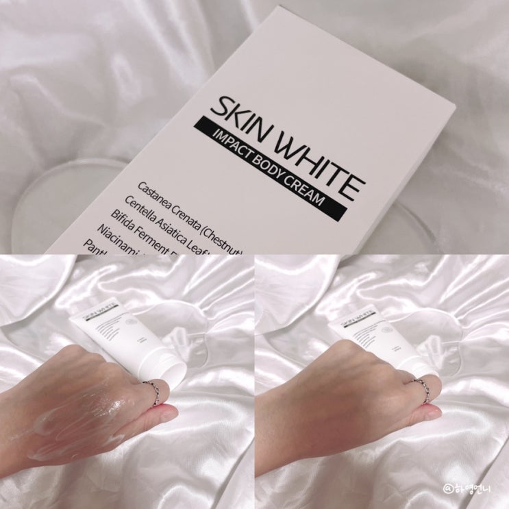 겨드랑이미백레이저 대신 스킨화이트 바디크림으로 색소침착관리
