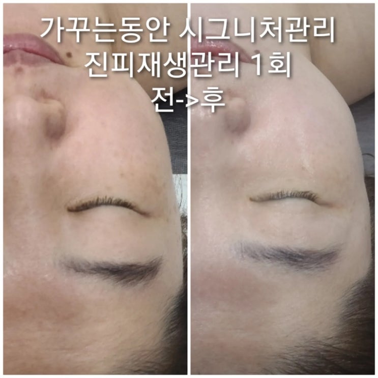  부천피부관리 '가꾸는동안' 노폐물 순환관리 추천