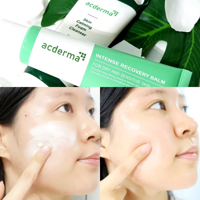 피부 트러블 마스크 여드름 진정에는 스팟케어 흉터 연고 추천!