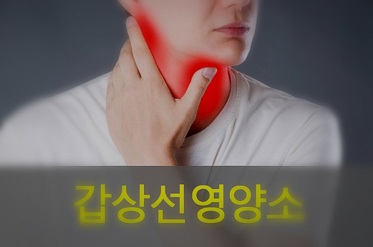  갑상선에 아이오딘, 요오드 영양제 효능 있나?