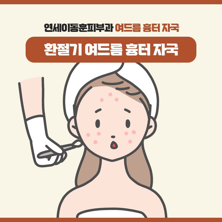 연세이동훈피부과 환절기에 많이 나타나는 여드름 흉터 자국