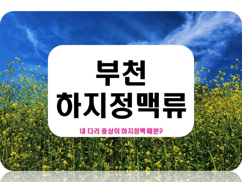 부천하지정맥류, 일찍 병원 찾으면 수술없이 치료가능해!
