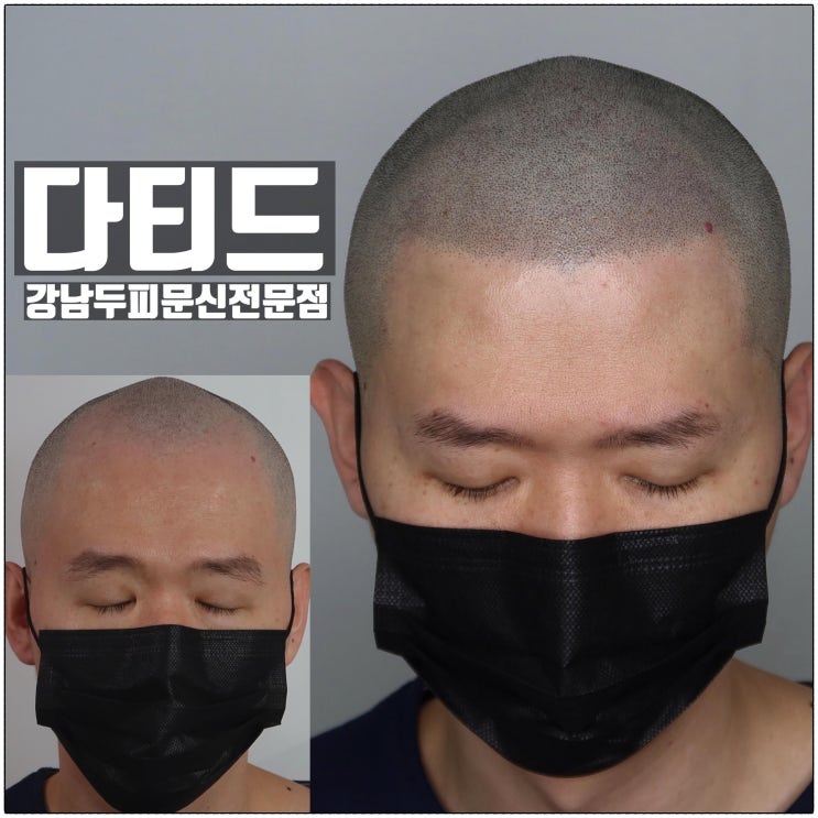 다티드 두피타투 강남두피문신 전문점 소개 다티드 두피타투 강남두피문신 전문점 소개