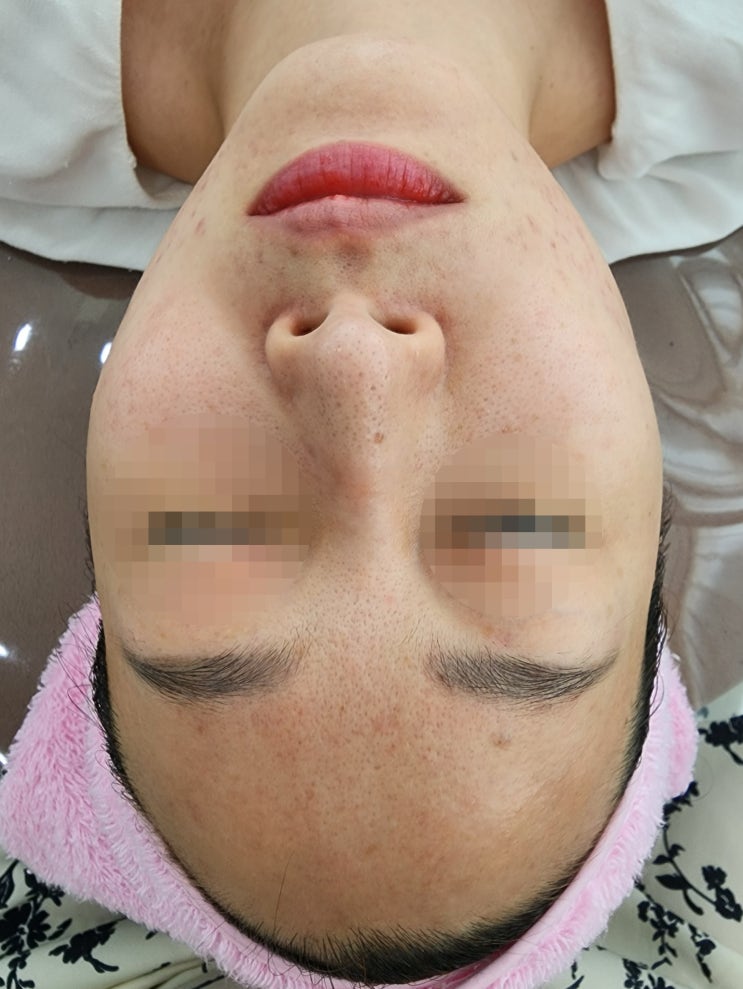 상동피부관리 토탈뷰티관리샵 써니뷰티 피부고민 안녕