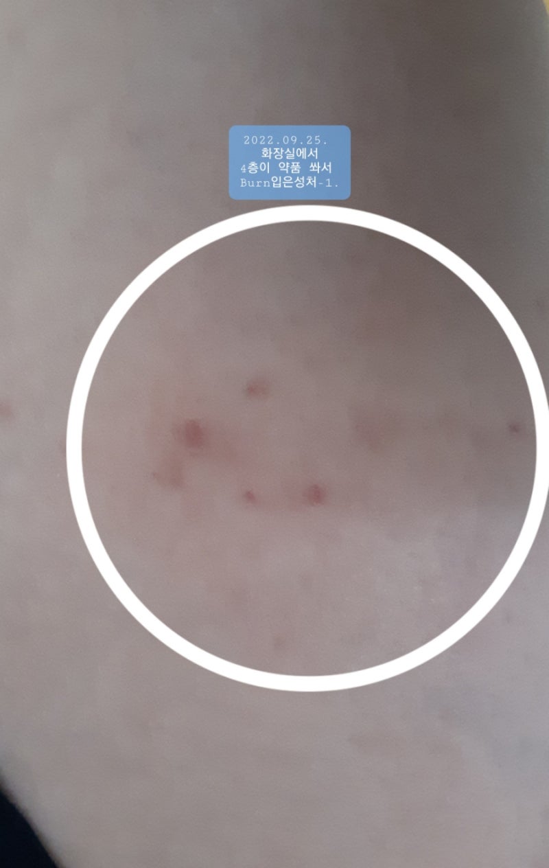 글로벌 딥스기업 하수인 조직스토킹 비트코인•흥신소걸레 : 네이버 블로그