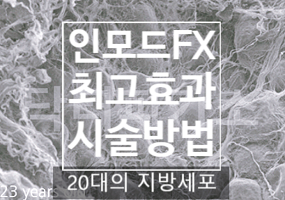  인모드FX '이렇게 받으면 최고효과 보장!바로 이렇게!' 완벽 뽀개기(4-3)