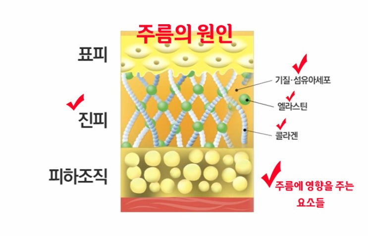  스티바 에이(A) 직구 후기