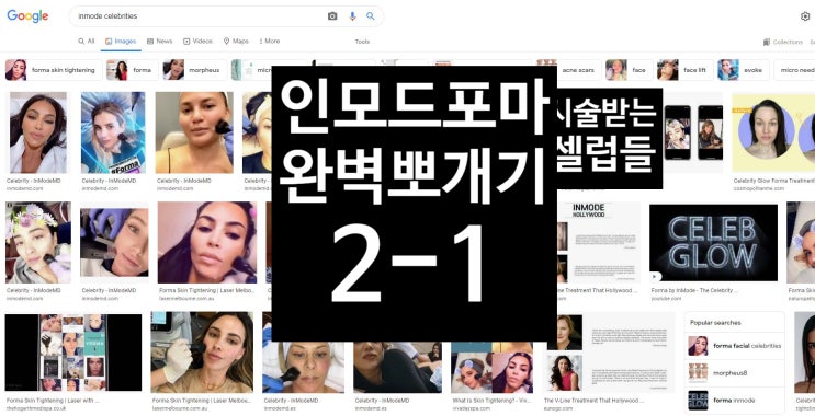 '너희가 인모드 포마 효과를 아느냐?'(인모드 포마 완벽 뽀개기 2-1)