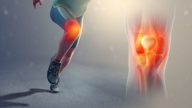 인천무릎재활/무릎 앞쪽 통증, 슬개대퇴증후군(PFPS,Patellofemoral pain syndrome)