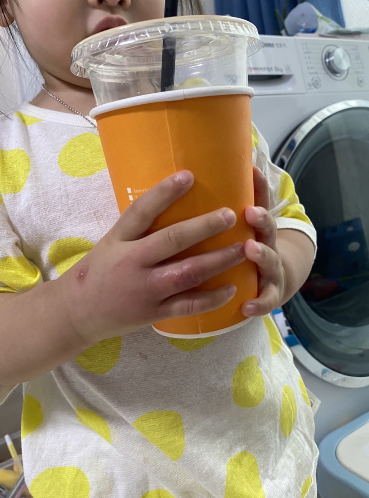  221004 연휴끝 봉와직염 시작