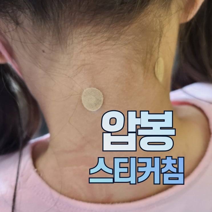  압봉 서암봉 스티커침 아이도 맞을 수 있는 붙이는침