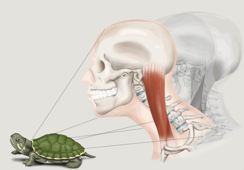 평택 일자목 평소 컴퓨터 사용이 많다면 조심해!