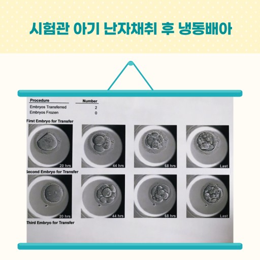  [알뜰정보] 시험관 동결배아란?