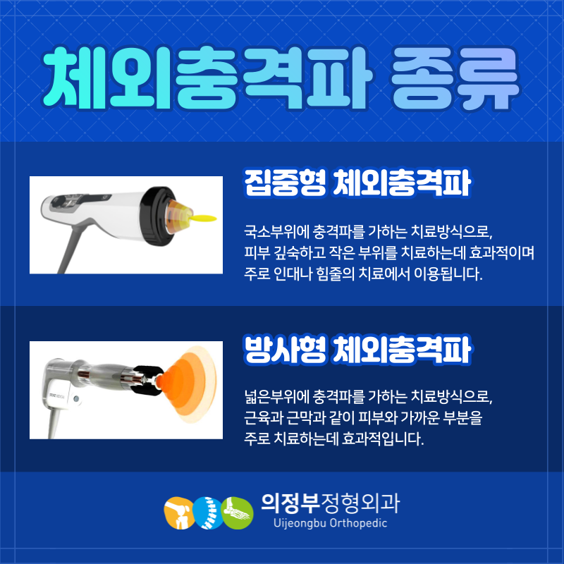 의정부성형외과 회전근개파열 체외충격파 치료, 약물치료 효과는?