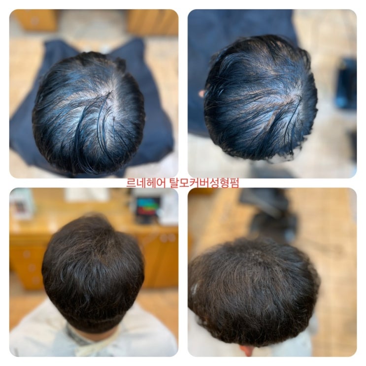  탈모전문 미용실에서만 할수있는 남자탈모펌 여자탈모펌 이야기 부산사상르네시떼미용실