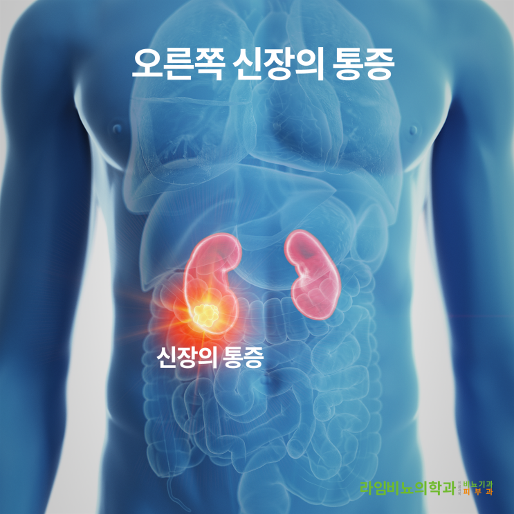 오른쪽 신장 통증의 6가지 잠재적 원인 : 첫 번째 - 일반적 원인