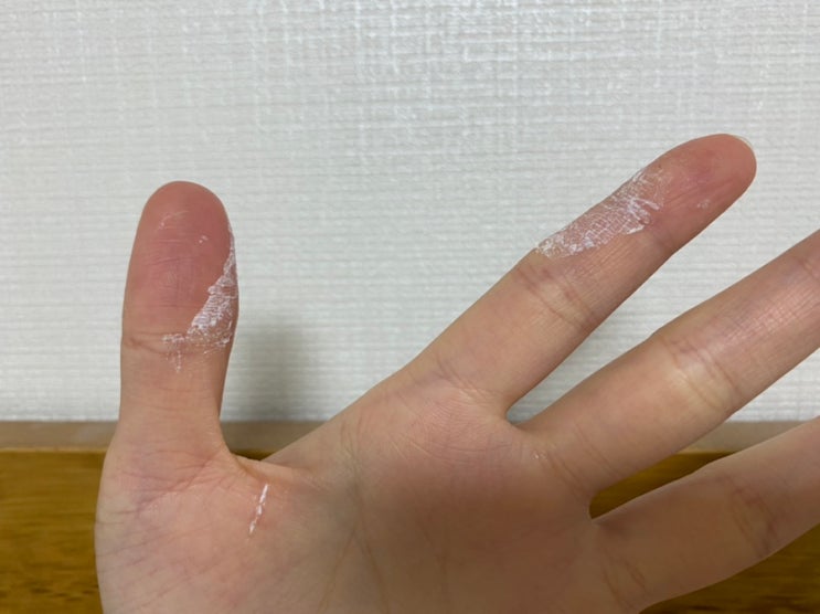  순간접착제 지우는법  손에 묻은 강력본드제거 경험담