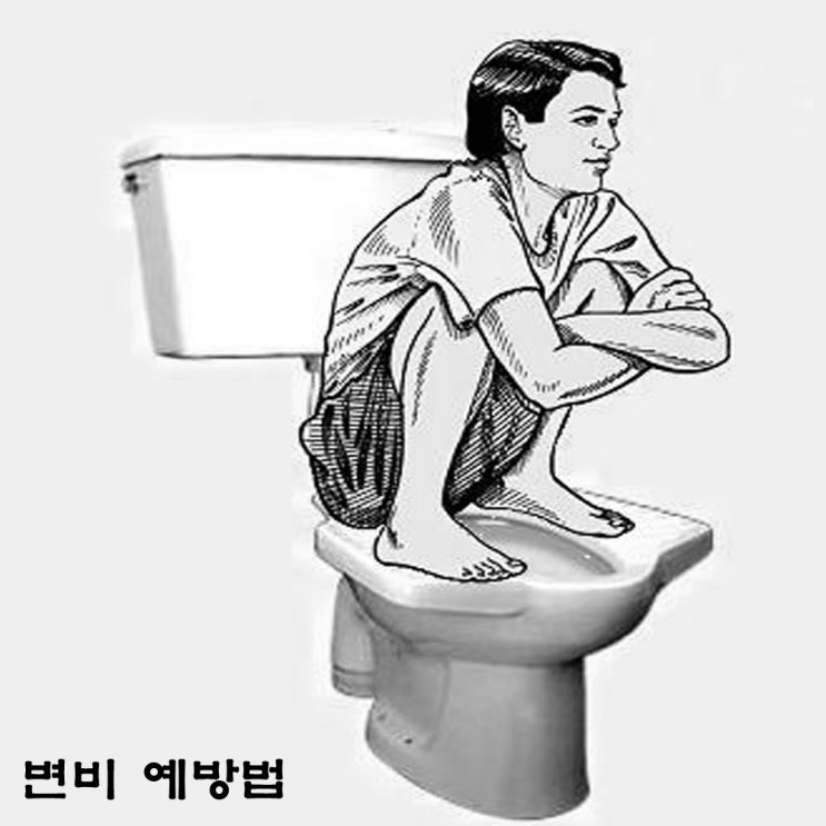  변비, 변비 예방법