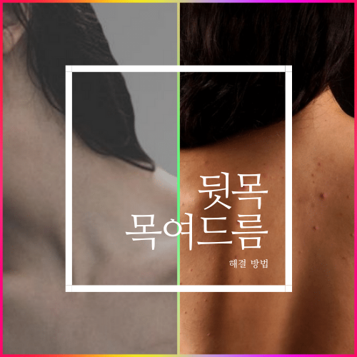 목 뒷목 여드름 원인 및 해결책 제시 목 뒷목 여드름 원인 및 해결책 제시