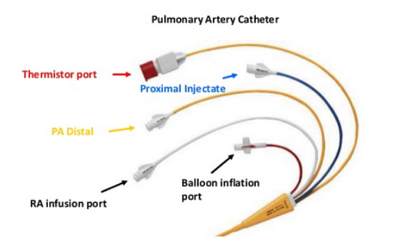 Cardiac catheterization ( 심도자술 ), Swan-Ganz Catheter : 네이버 블로그