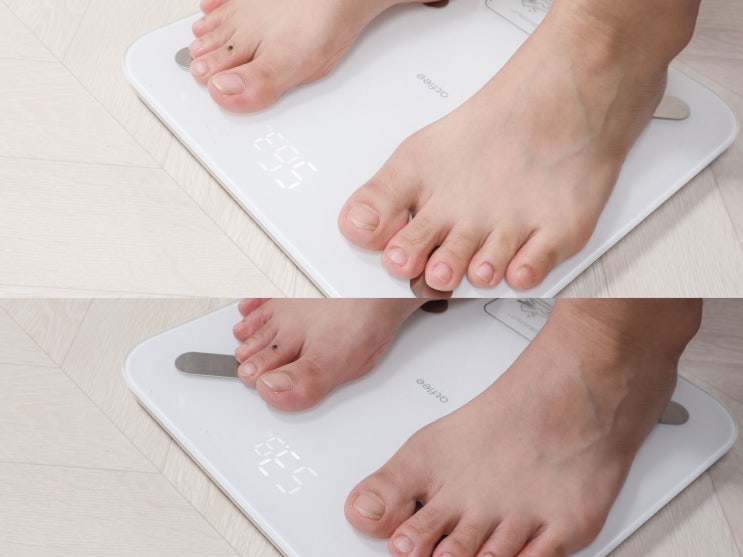  강남다이어트한약 감비환 스틱 내돈내산 2주 후기!