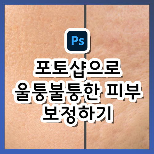  [포토샵 강의] 울퉁불퉁한 피부 보정하기