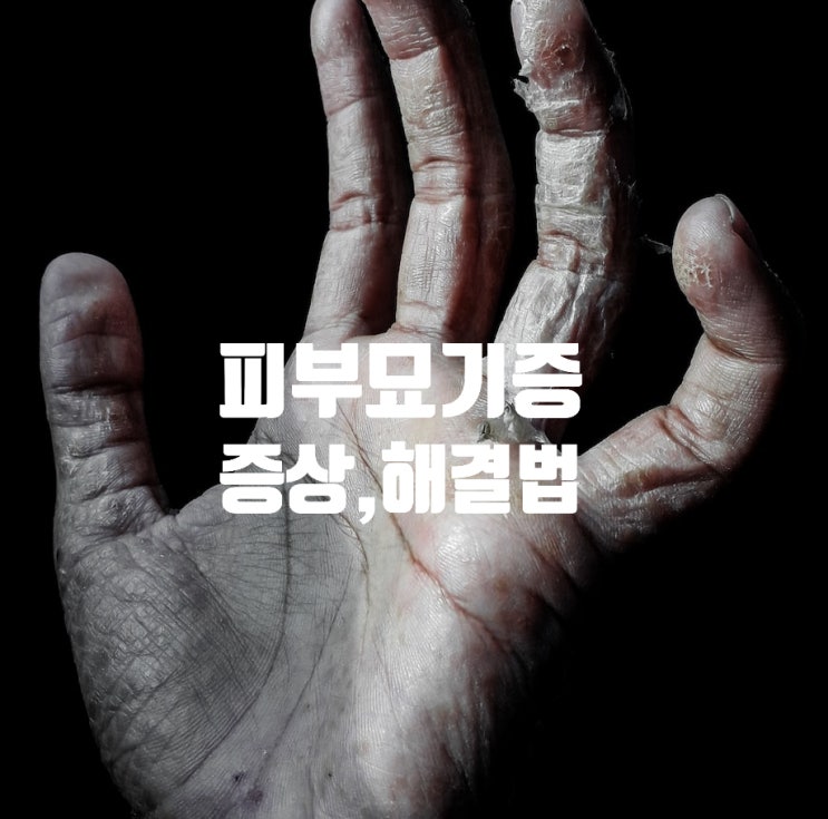  피부 묘기증, 증상 원인 해결방법 음식 추천