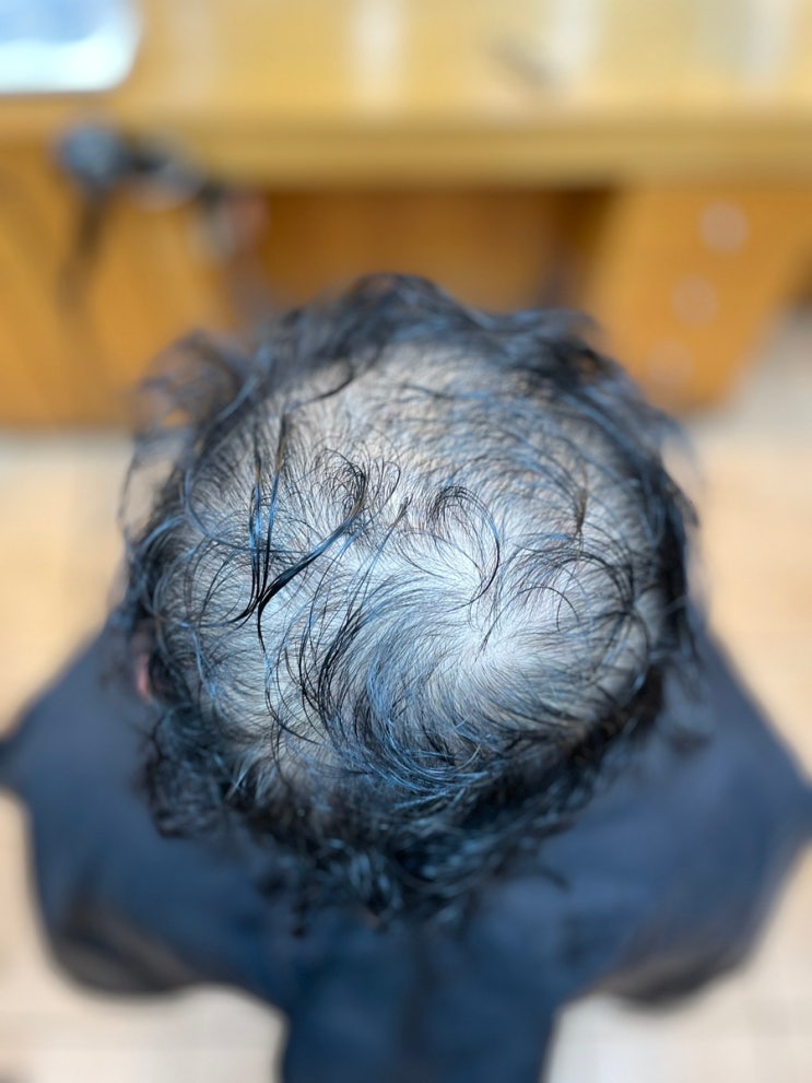  남자극한탈모펌의 한계를 뛰어넘다 부산사상탈모관리전문미용실 르네시떼 탈모커버성형펌