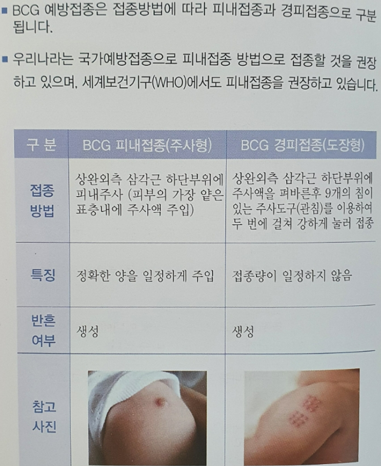 신생아 bcg 접종 피내용과 경피용 고민될 때 ( 8개월 지난 후 피내용 흉터까지 공개 )