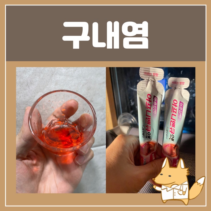  구내염빨리낫는법 구내염 가글 치료제 아프니벤큐 입안 헐었을 때 치료에 도움되는 제품