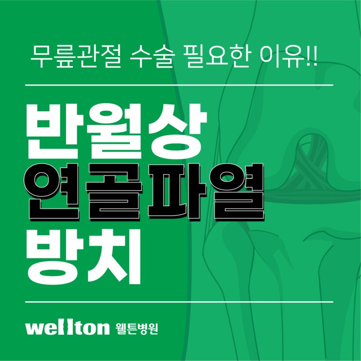  반월상연골파열 방치 하면 무릎관절 수술 필요