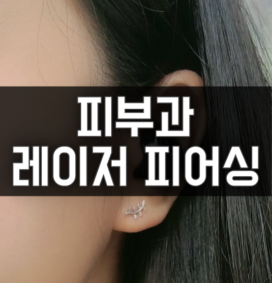  [피어싱] 피부과 레이저 피어싱 내돈내산  _강한신림의원