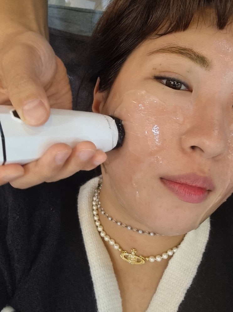  [내돈내산리프테라3000샷]솔직후기/이벤트가격,주기,통증,부작용/영등포피부과/리프팅레이져 효과