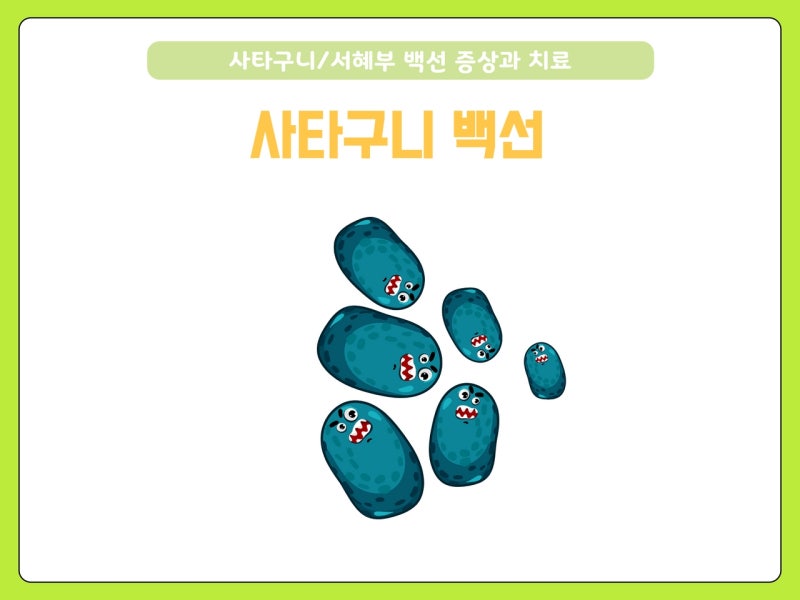 여자 서혜부/ 남자 사타구니 완선(백선) 원인과 증상: 습진, 무좀, 가려움, 음낭, 항문, 연고 : 네이버 블로그
