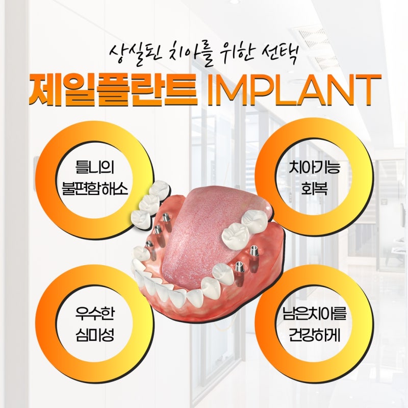 좋은 치과를 위한 수원임플란트의 기준