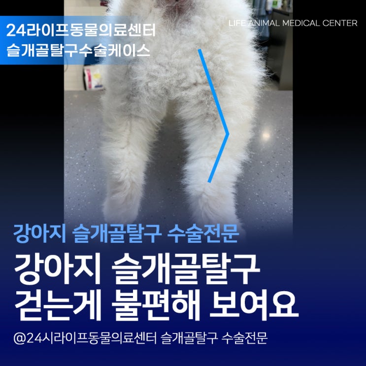 대구 강아지 슬개골탈구 수술 전문 : 2살 포메라니안 아가, 걷는게 불편해보여요 슬개골탈구 3기 수술 대구 강아지 슬개골탈구 수술 전문 : 2살 포메라니안 아가, 걷는게 불편해보여요 슬개골탈구 3기 수술