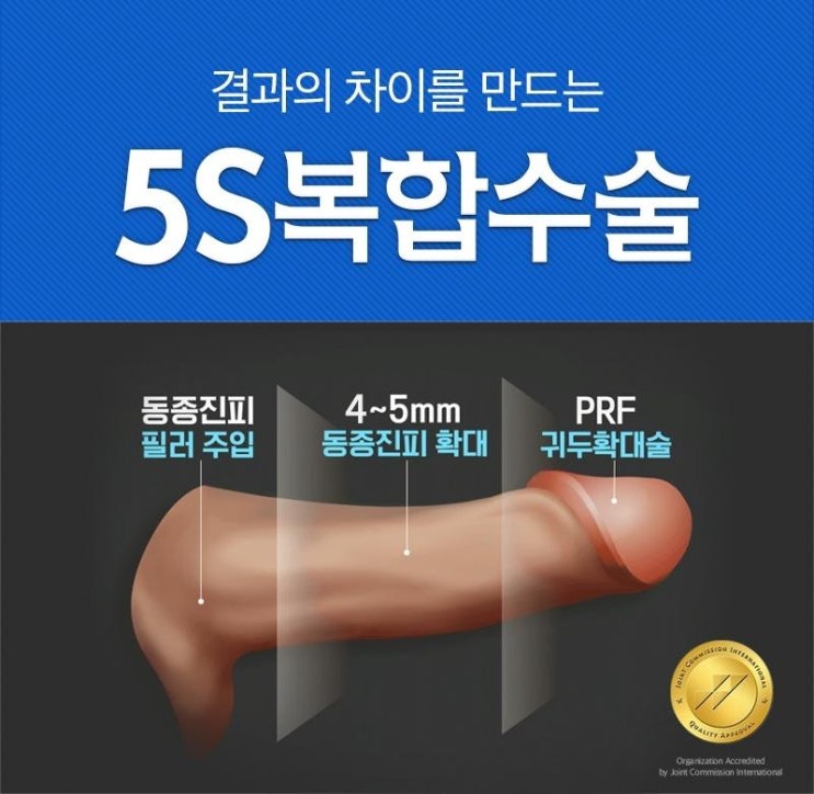  대한민국 5대 남성수술 문제 한번에 해결 [5S복합수술] 3년 연속 진피이식 1위