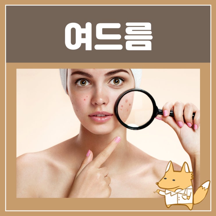  여드름 치료연고 위치별, 크레오신 가격 효과 : 클린다마이신 여드름 항생제
