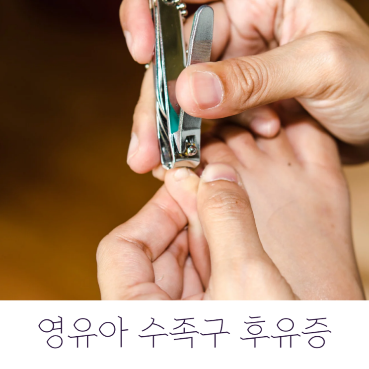  영유아 수족구 후유증 손발톱 빠짐?